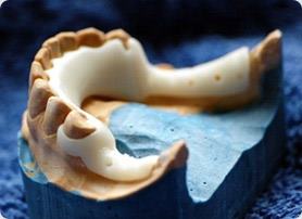 Mag-Dent TECHNIK DENTYSTYCZNY (EKSPRESOWA NAPRAWA PROTEZ)