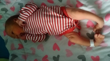 Mała Hania potrzebuje pomocy. Cierpi na rzadką chorobę stóp