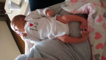 Mała Hania potrzebuje pomocy. Cierpi na rzadką chorobę stóp