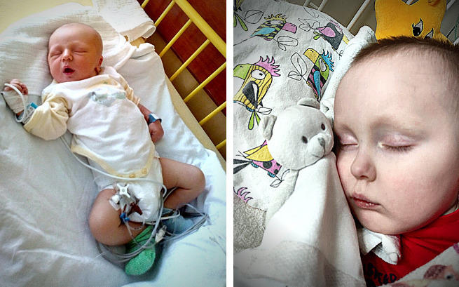 Uratujmy Filipa! Na operację trzylatka potrzeba ogromnych pieniędzy!