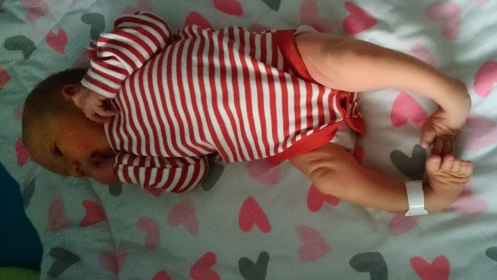 Mała Hania potrzebuje pomocy. Cierpi na rzadką chorobę st&oacute;p