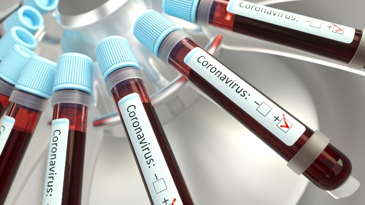 Koronawirus COVID-19 w Wielkopolsce. Zarażony młody mężczyzna