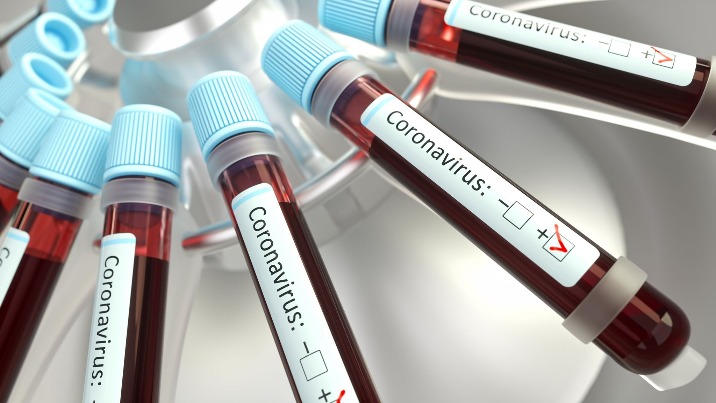 65 nowych przypadków zakażenia koronawirusem w Wielkopolsce