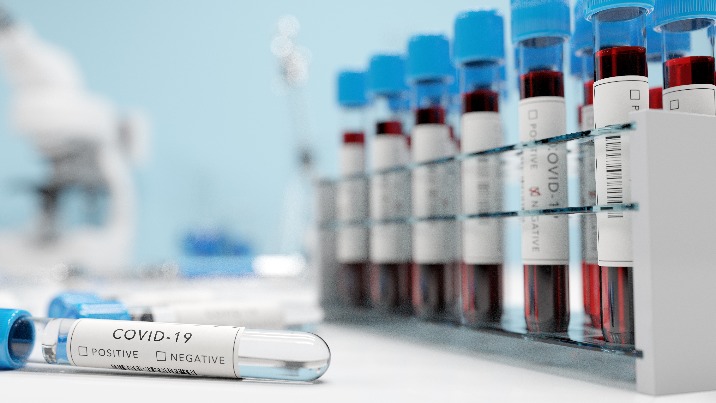 Koronawirus w Wielkopolsce. Nowe zakażenia w naszym regionie