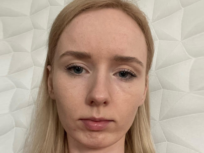 Policjanci zbierają pieniądze dla córki swojego kolegi. Potrzebna operacja