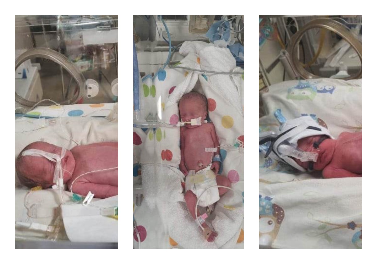 Gmina Golina. Pierwsze w historii trojaczki