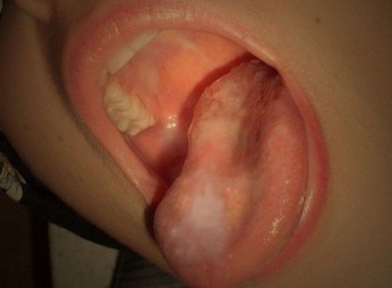 Łaska z połykiem i głębokie gardło